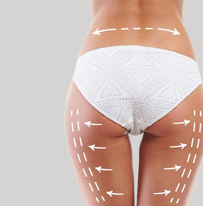lipolaser