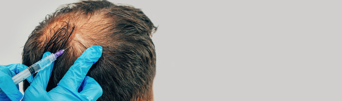 Prp Capelli